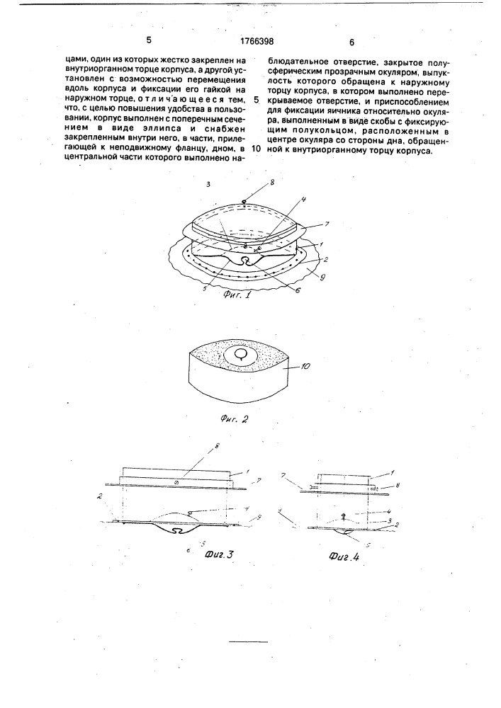 Устройство для обследования внутренних органов животных (патент 1766398)