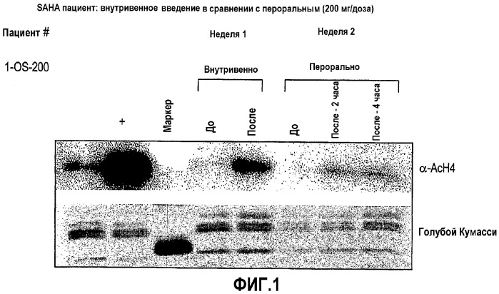 Способы лечения рака с использованием ингибиторов hdac (патент 2356547)