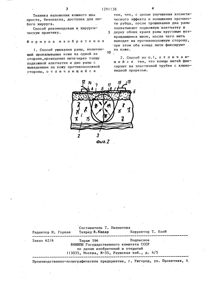 Способ ушивания раны (патент 1291138)