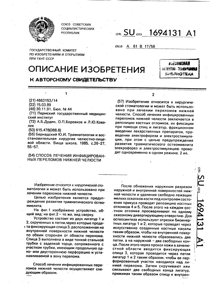 Способ лечения инфицированных переломов нижней челюсти (патент 1694131)