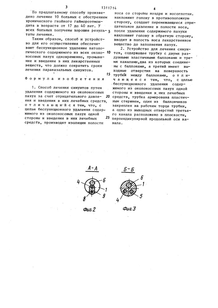 Способ лечения синуитов и устройство для его осуществления (патент 1311714)