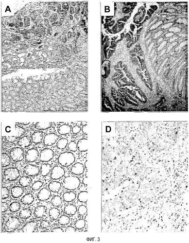 Связанный с раком толстого кишечника ген том34 (патент 2526196)