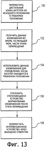 Улучшенный катетер (патент 2527668)