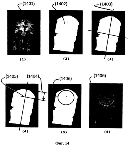 Система и способ для автоматического планирования видов в объемных изображениях мозга (патент 2523929)
