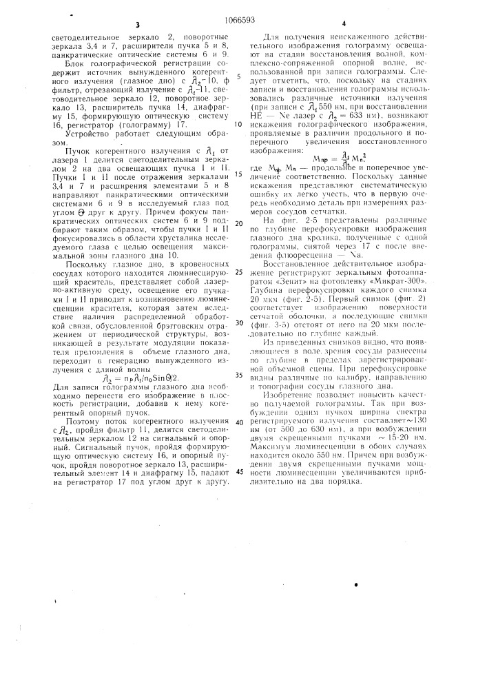 Способ регистрации объемного изображения глазного дна (патент 1066593)