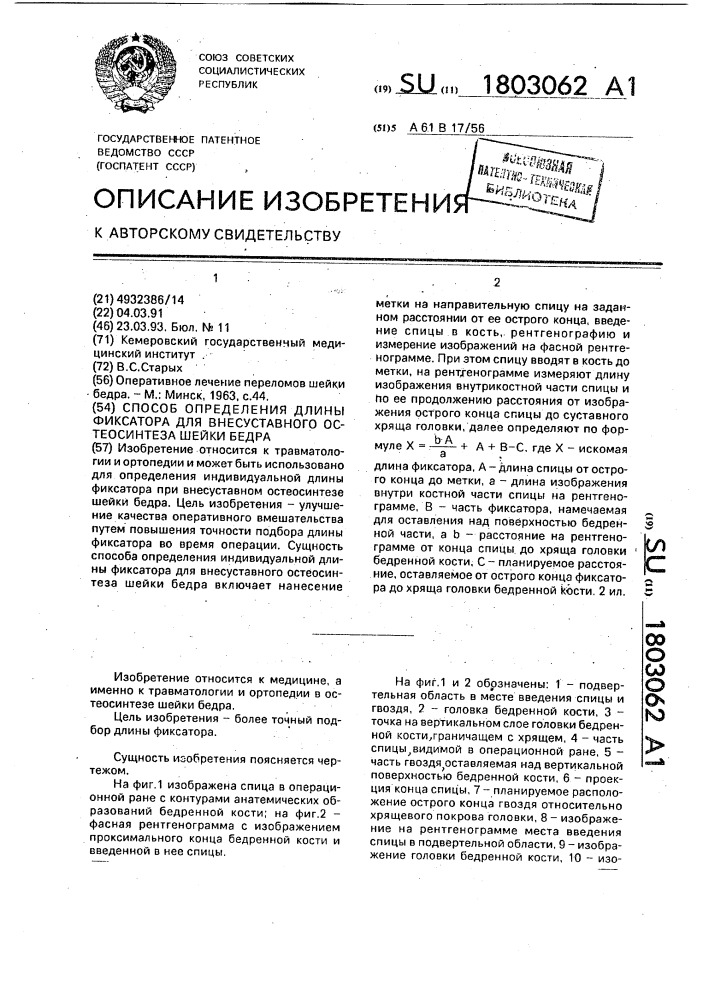 Способ определения длины фиксатора для внесуставного остеосинтеза шейки бедра (патент 1803062)