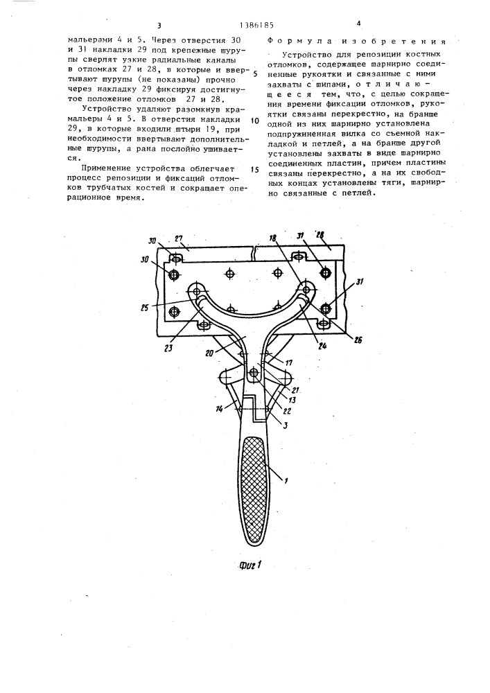 Устройство ш.б.ахмедова и н.ш.ахмедова для репозиции костных отломков (патент 1386185)