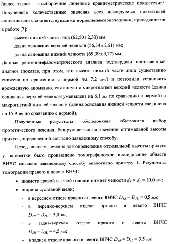 Способ определения оптимальной высоты прикуса (патент 2354300)