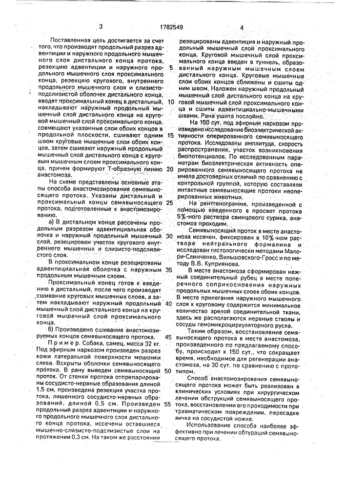 Способ анастомозирования семявыносящего протока (патент 1782549)