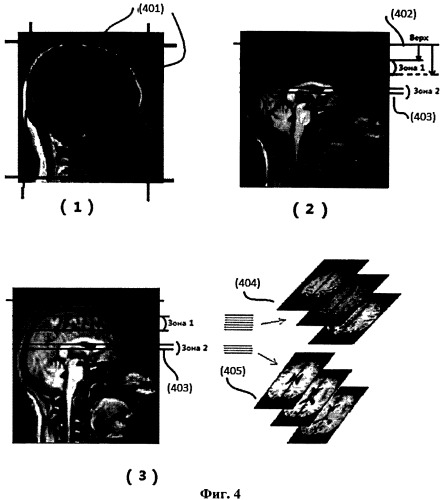Система и способ для автоматического планирования видов в объемных изображениях мозга (патент 2523929)