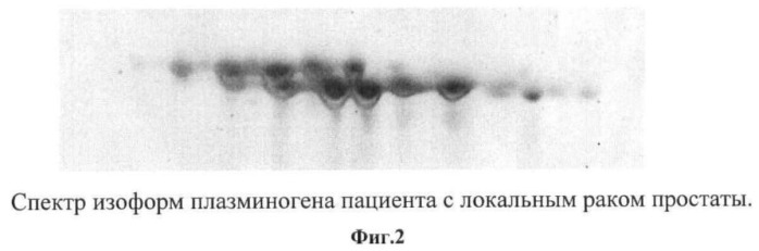 Способ дифференциальной диагностики рака предстательной железы (патент 2469333)