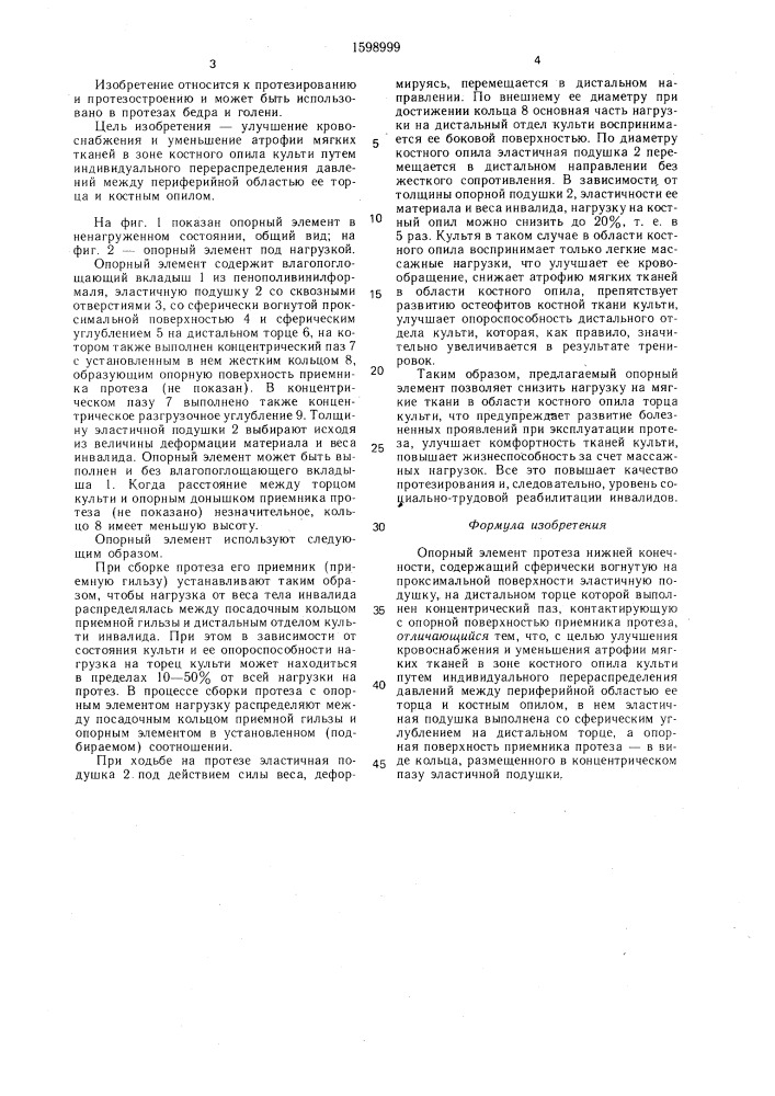 Опорный элемент протеза нижней конечности (патент 1598999)