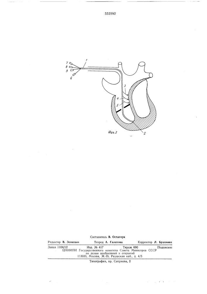 Зонд для эндокардиальной стимуляции сердца (патент 555892)