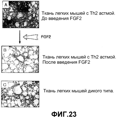 Средство, содержащее fgf2 в качестве активного ингредиента, для лечения или профилактики астмы и хронических обструктивных заболеваний легких (патент 2351356)