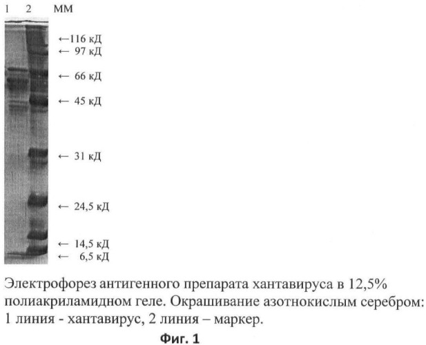 Способ обнаружения антител к хантавирусу при геморрагической лихорадке с почечным синдромом и прогнозирование тяжелых форм заболевания (патент 2484478)