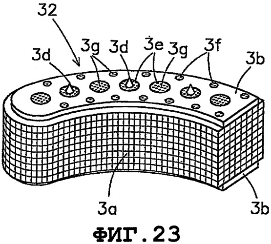 Зажимы для вставки искусственного межпозвоночного диска, зажимный набор и искусственный межпозвоночный диск (патент 2362518)