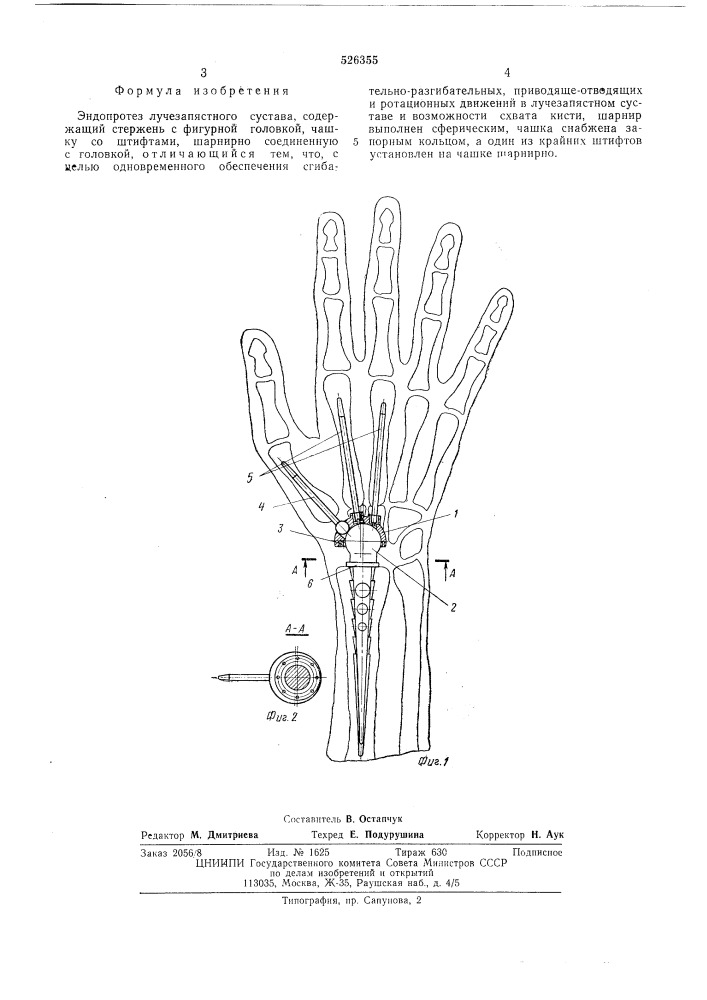 Эндопротез лучезапястного сустава (патент 526355)