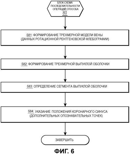 Система для комплексного слияния данных формирования изображения на основании статистических моделей анатомии (патент 2472442)