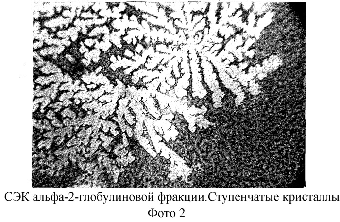 Способ экспресс-диагностики эндогенной интоксикации (патент 2280865)