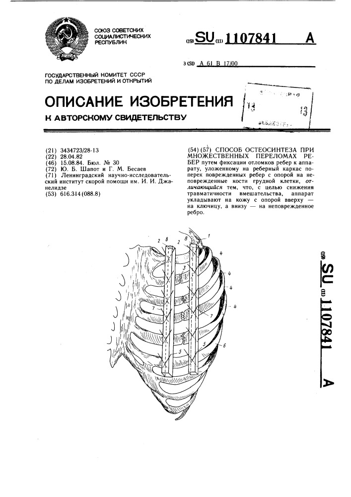 Способ остеосинтеза при множественных переломах ребер (патент 1107841)