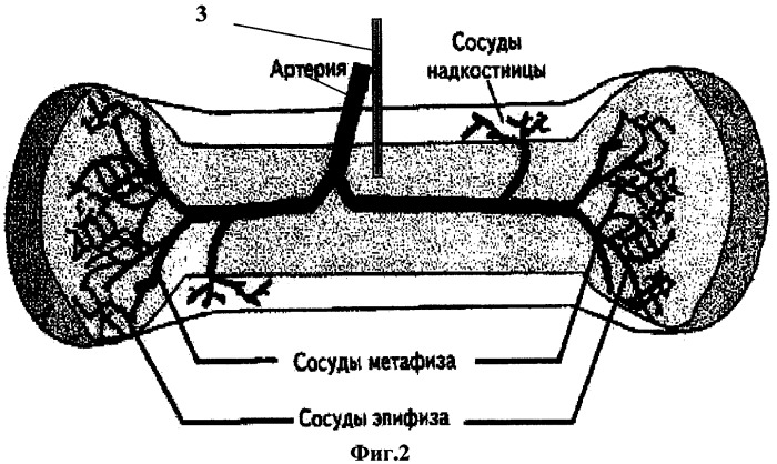 Способ прижизненного забора костного мозга у животных (патент 2290093)