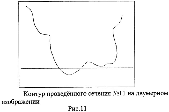 Способ контроля препарирования окклюзионной поверхности зубов при ортопедическом лечении несъемными протезами (патент 2396921)