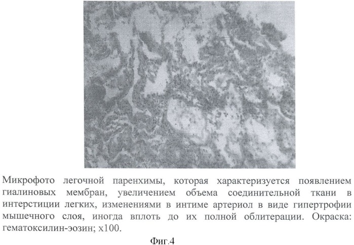 Способ моделирования острого повреждения легких (патент 2456677)