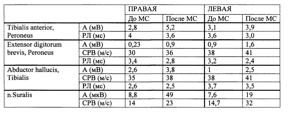 Способ восстановления функции нервов (патент 2662657)