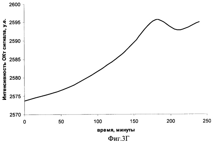Способ лечения опухолей лазерной гипертермией (патент 2425701)
