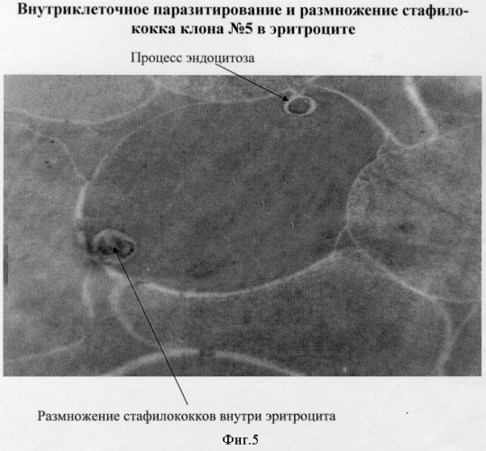 Способ прогнозирования развития анемии при гнойно-воспалительных заболеваниях (патент 2296336)