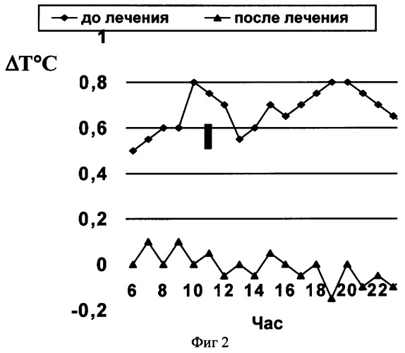 Способ диагностики функциональных и патологических процессов в организме человека или животного (патент 2251385)