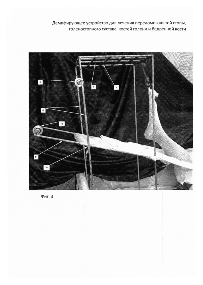 Демпфирующее устройство для лечения переломов костей стопы, голеностопного сустава, костей голени и бедренной кости (патент 2645956)