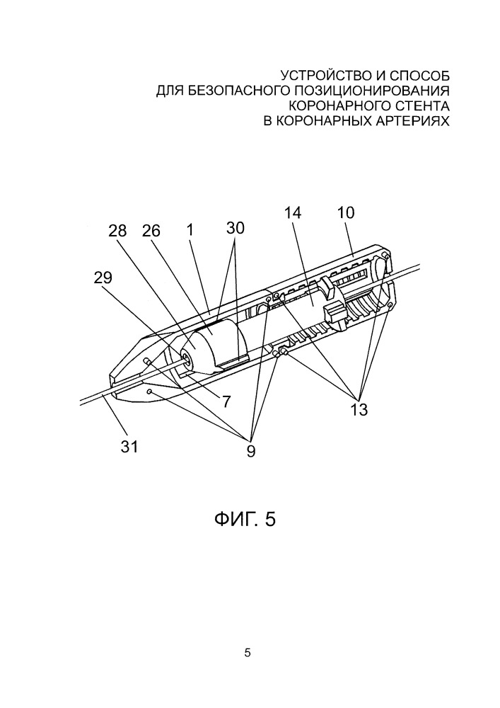 Устройство и способ для безопасного позиционирования коронарного стента в коронарных артериях (патент 2661092)