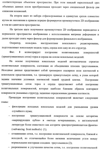 Способ неинвазивного электрофизиологического исследования сердца (патент 2417051)