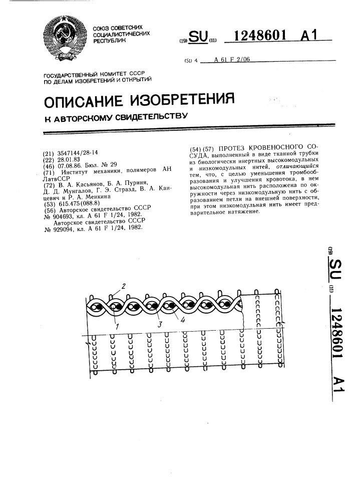 Протез кровеносного сосуда (патент 1248601)