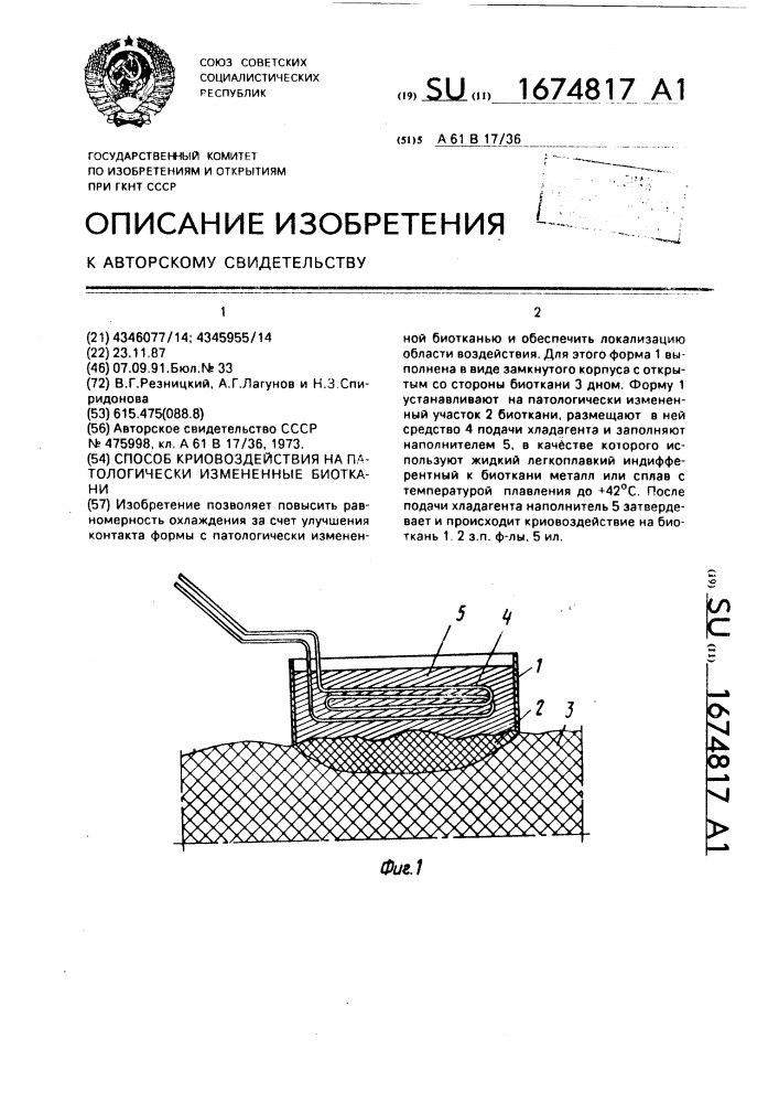 Способ криовоздействия на патологически измененные биоткани (патент 1674817)