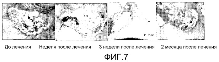 Стабильные фармацевтические составы, которые содержат интерфероны гамма и альфа в синергичных соотношениях (патент 2403057)