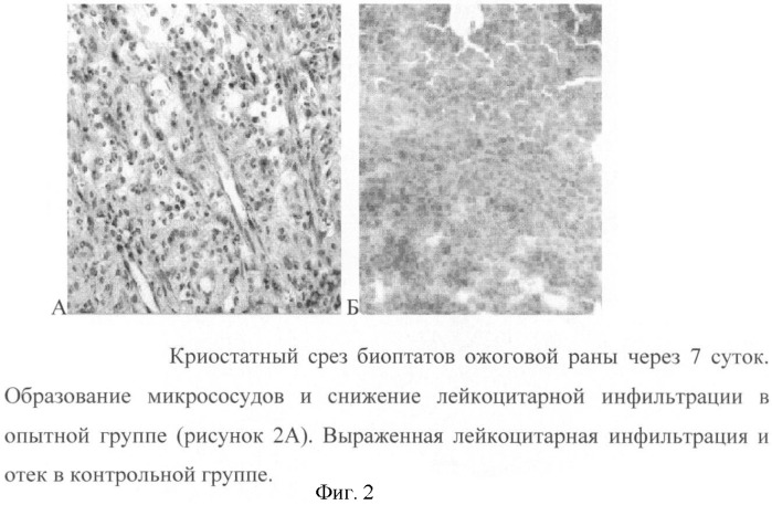 Композиция для стимулирования роста и регенерации клеток, (варианты), а также способ ее получения (варианты) (патент 2391990)