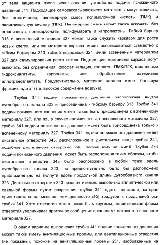 Устройство для лечения путем подкожной подачи пониженного давления с использованием разделения с помощью воздушного баллона (патент 2401652)