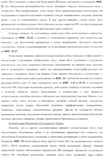 Стент из скользящих и блокирующих элементов (патент 2429801)