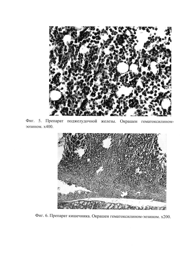 Способ моделирования лимфогенного и гематогенного метастазирования мышиной меланомы в16 у белых нелинейных крыс (патент 2615908)