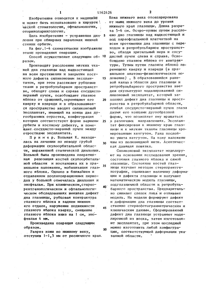 Способ репозиции глазного яблока при переломах нижней стенки орбиты (патент 1162426)