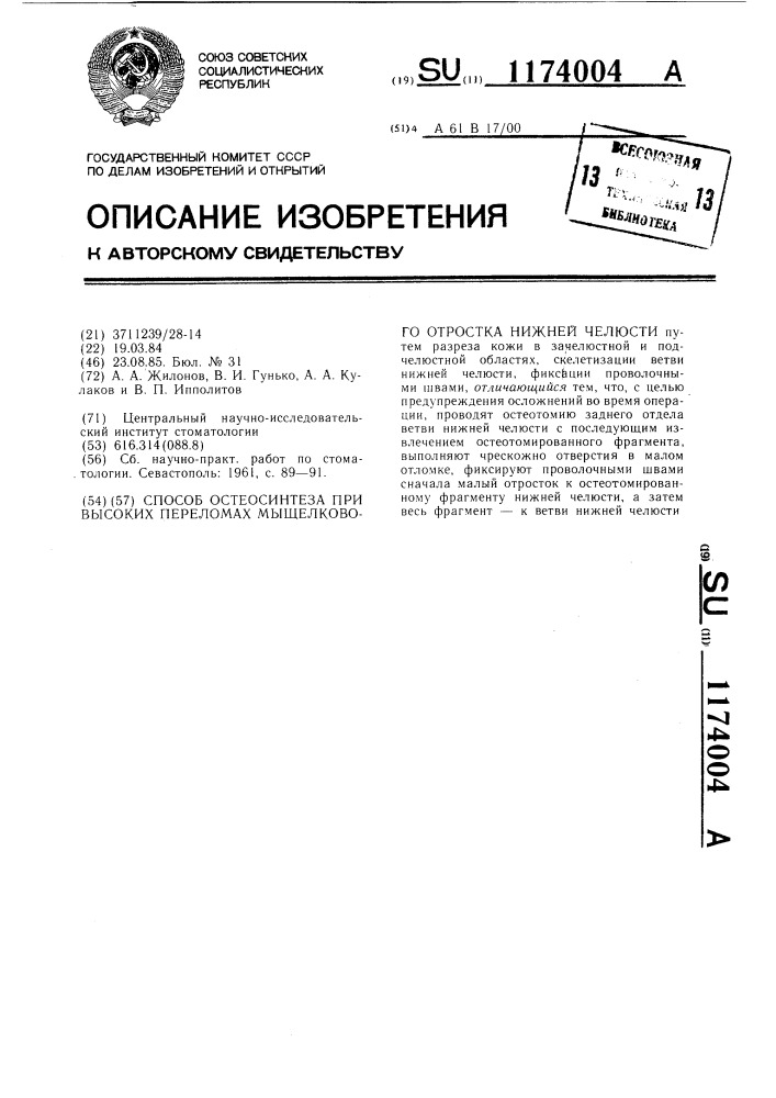 Способ остеосинтеза при высоких переломах мыщелкового отростка нижней челюсти (патент 1174004)