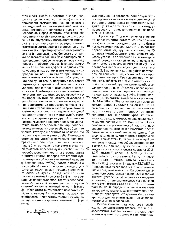 Способ оценки репаративного остеогенеза на гистологическом препарате (патент 1816989)