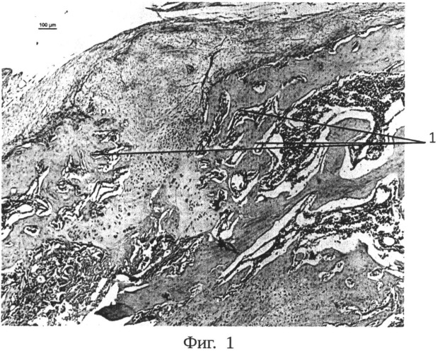 Способ моделирования остеорезорбции в условиях репаративного остеогенеза (патент 2524128)