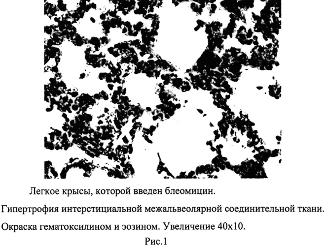 Средство для коррекции нарушений в легочной ткани при цитостатическом воздействии (патент 2554776)