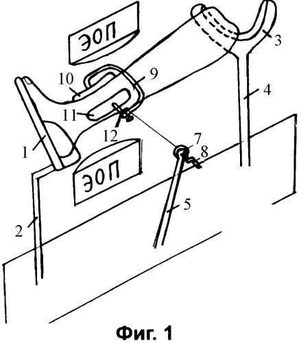 Способ проведения управляемой неинвазивной закрытой аппаратной репозиции и фиксации переломовывихов в затвердевающей повязке (патент 2363406)