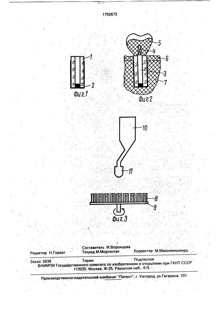 Зубной имплантат (патент 1750673)