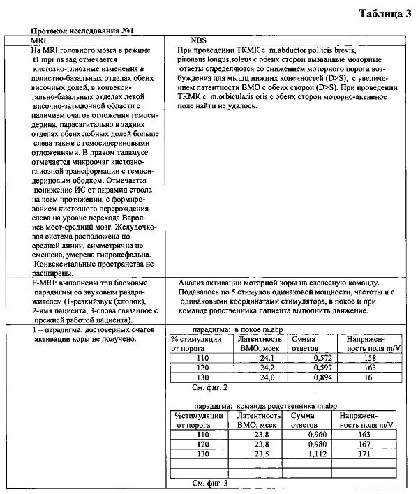 Способ диагностики нарушения сознания (патент 2596049)