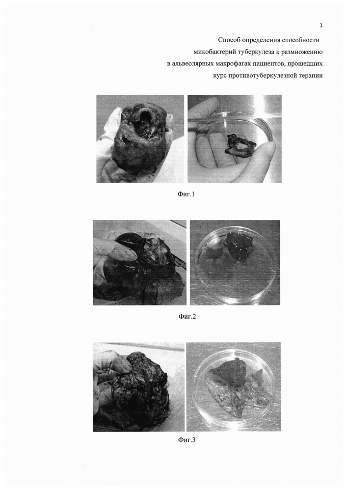 Способ определения способности микобактерий туберкулеза к размножению в альвеолярных макрофагах пациентов, прошедших курс противотуберкулезной терапии (патент 2652882)